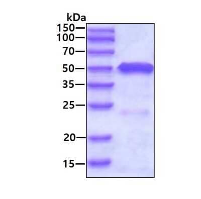 SDS-PAGE Recombinant Human Testin His Protein